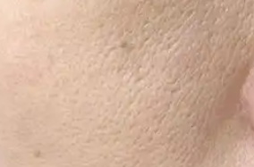 抗衰必看！干纹细纹的急救与焕肤指南-50227