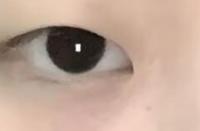 在上大学之前是否建议割双眼皮