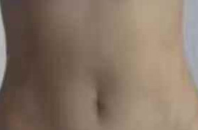 炎炎夏季来临想穿小裙子 有什么办法能瘦下来呢