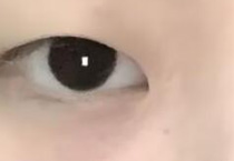 双眼皮怎么选不后悔？4种适用人群及设计要点