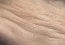 多种方法揭秘让你告别“抬头纹星人”