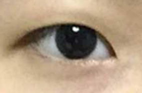 如何选择双眼皮的形状和宽度