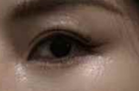 如何get妈生双眼皮？这是不是你的梦中情眼？