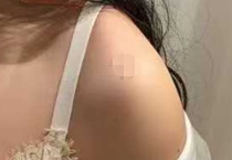 告别“虎背熊腰”！塑造夏日迷人肩颈线