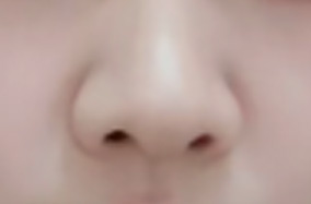 隆鼻后皮肤会不会松弛？-51480