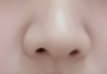 想隆鼻的姐妹看过来！看懂这些知识点不踩雷