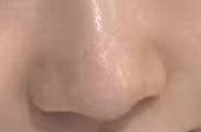 想趁暑期隆鼻，如何拥有自然款“妈生鼻”-51523