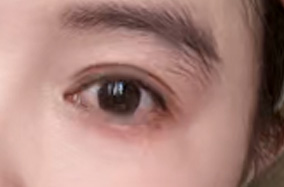 暑期双眼皮攻略，看这篇就值了