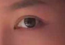 想在暑期做个双眼皮？考虑好这几点，实现完美蜕变不翻车