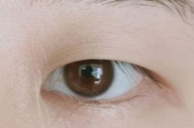 想做医美眼修复方式必看