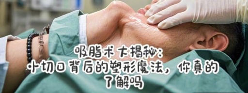 吸脂术大揭秘：小切口背后的塑形魔法，你真的了解吗？