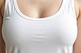 隆胸假体材料大比拼：硅胶、膨体、自体脂肪如何选择？