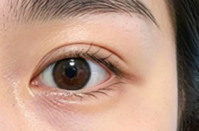 男性双眼皮设计在审美上具有哪些独特特点？