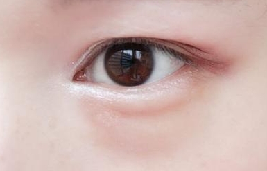 眼袋“元凶”大揭秘！这些因素你中招了吗？