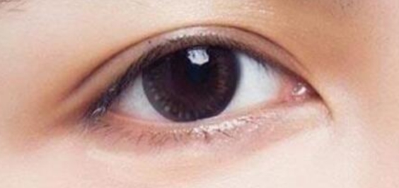 双眼皮术后脱落别慌！科学应对方案全解析
