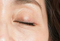 每天睡眠充足却有眼袋？科学解读及应对方法大公开