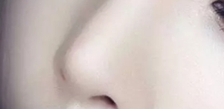 鼻综合整形术前必看！这些“神器”让你术后恢复快人一步