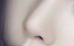 鼻综合整形术前必看！这份超全物品准备清单让你术后无忧