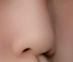 鼻综合整形术前小贴士：隐形眼镜与框架眼镜的取舍之道