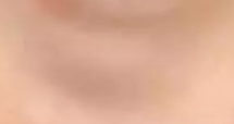 眼袋突现竟和肾病有关？这些信号千万别忽视！