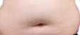 吸脂后皮肤“垮掉”？真相揭秘：3招教你术后紧致如初！