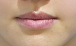 机打水光和手打水光有何区别，到底该如何选择？