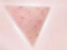 常见的医美项目术后的并发症该如果应对？