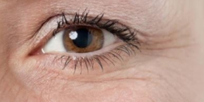 引起眼部容易衰老的几大原因来了！