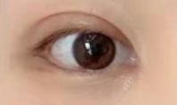 开眼角后“保鲜”秘籍：3个习惯让你的眼睛美得更持久！
