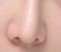 鼻综合整形前必看！术前1周禁酒真相大揭秘