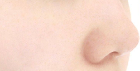 水光注射除了补水，好处比你想的还多！