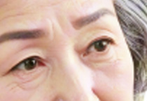 秋季割双眼皮：老年人适不适合的深度探讨