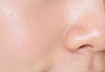 热玛吉VS超声刀，秋季抗衰如何选择？
