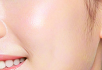 秋季医美+旅行:出游期间如何护理