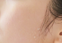 秋季医美后不能洗澡？真相与误区解析