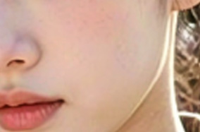 20岁军训后需要做抗衰项目吗-54727