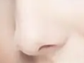 隆鼻后还是