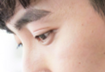 不是谣言！年轻人也要警惕青光眼