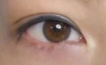 开眼角必看！疤痕真相大揭秘：如何让术后痕迹