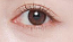 下睑下至术：让“吊梢眼”秒变“无辜犬眼”的魔法手术？真相与风险全揭秘！
