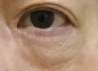 眼袋大≠老得快？揭秘眼袋背后的真实原因！