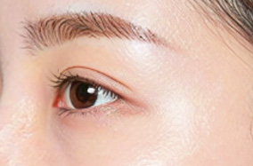 国庆变美计划：做双眼皮后能否开启旅游模式