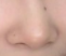 垫鼻尖风险全揭秘！短期肿胀VS长期变形，如何避开“变美陷阱”？
