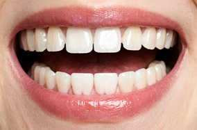 牙齿矫正戴完牙套后,可以不复诊吗?