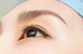 双眼皮修复手术费用揭秘:难度与失败复杂度影响价格