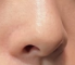 垫鼻尖后急着纹眉？小心感染风险！术后1个月这些禁忌要牢记-55243