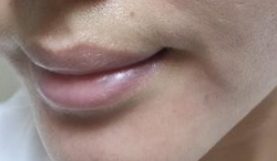 瘦脸期间想喝酒?先看看酒精如何“毁”掉你的瘦脸计划!-55246