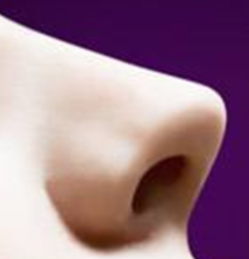 鼻孔矫正全解析:从形态到功能,一次手术解决这些困扰!