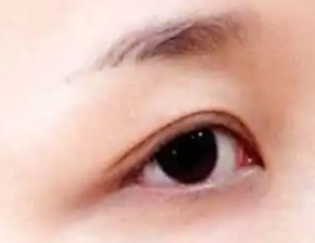 眉毛种植的适用和禁忌人群!