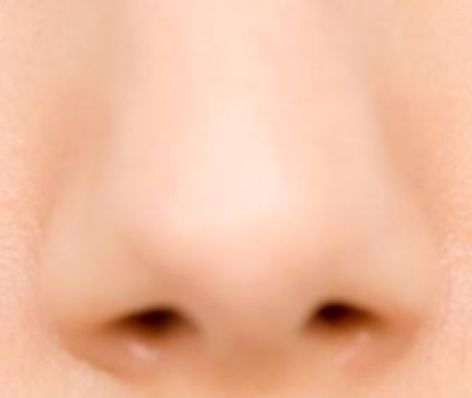 垫鼻尖术后感染危机？紧急应对指南：速联医生，科学处理！